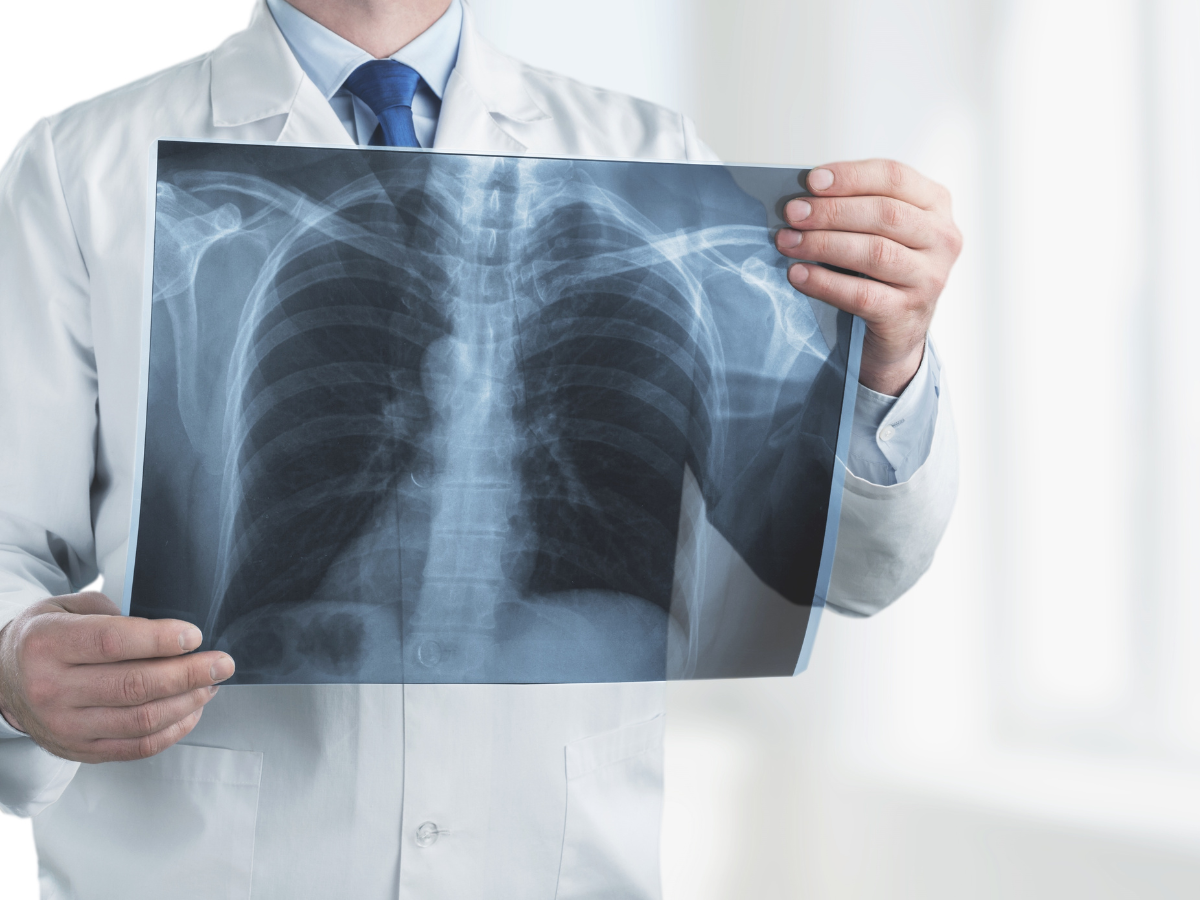 fibrosi cistica a 50 anni: cosa sapere per gestirla con serenità - Eurofins Genoma