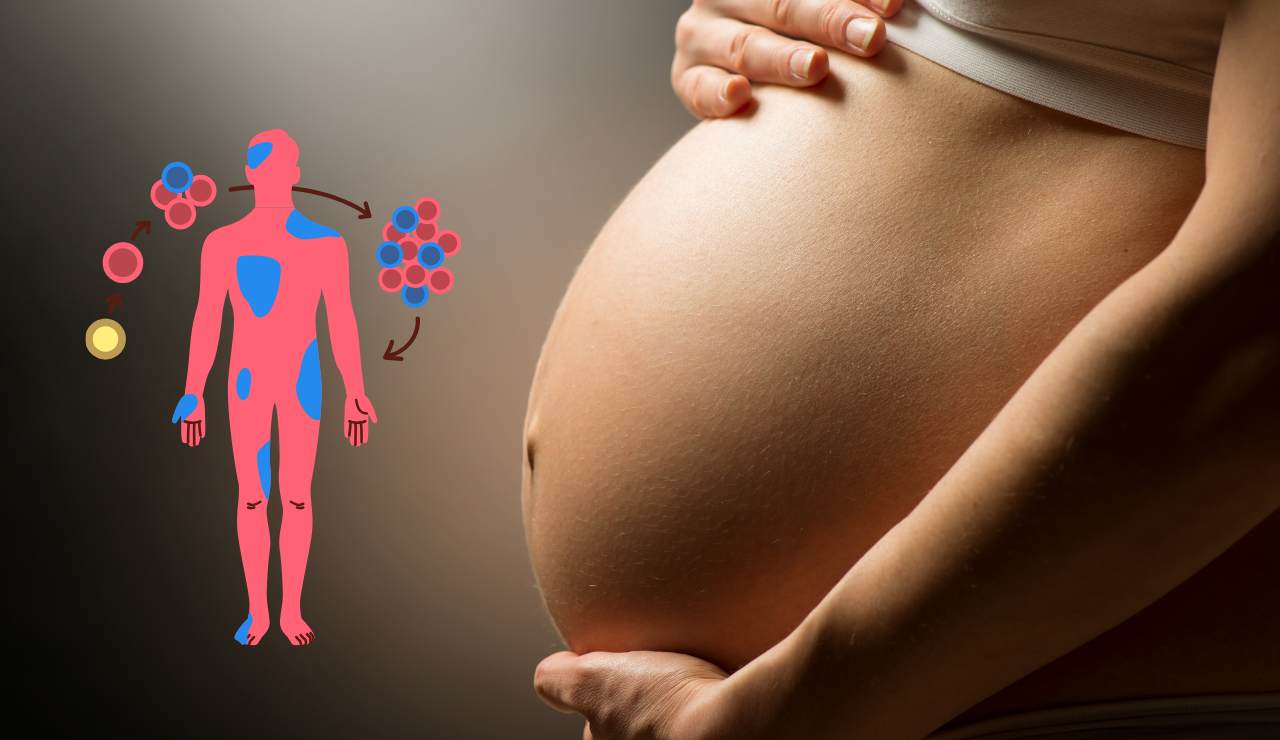 Mosaicismo fetale e placentare